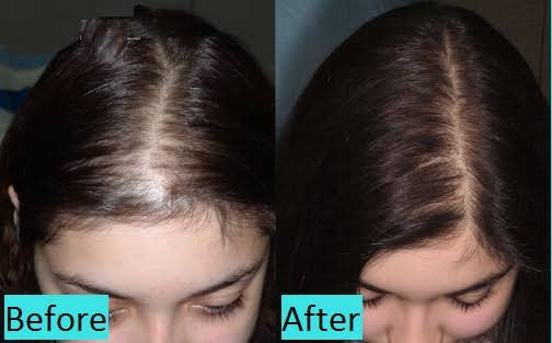 Hair Treatments | Image 2